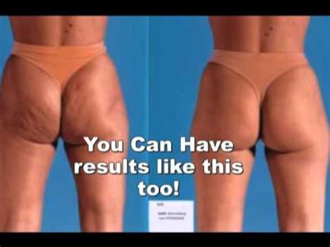 Cellulite creams work by improving the circulation in the skin which makes it easy to burn fat and toxins from the body. Best Cellulite Treatment Cream - Best Cellulite Treatment ...