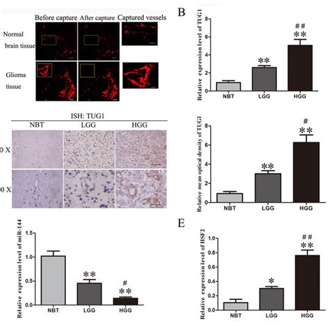 the expressions of tug1 mir 144 and hsf2 in human glioma vascular download scientific diagram