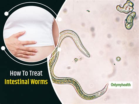 Intestinal Worms Causes Symptoms And Prevention Tips Intestinal