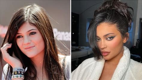 Kylie Jenner Denies Having Undergone Extensive Plastic Surgery Gets