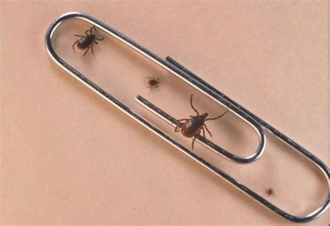 5 Easy Ways To Get Rid Of Ticks In Your Yard