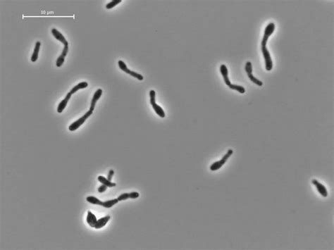 Bifidobacterium Longum Aqua Supplement एक्वा फीड सप्लीमेंट मछलियों