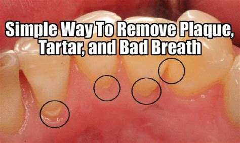this one ingredient will get rid of your plaque bad breath and remove tartar