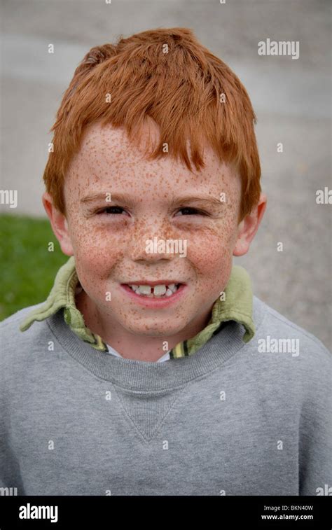 Red Hair Boy With Freckles Stock Photo 29352985 Alamy