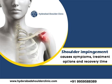 Shoulder Impingement Causes Symptoms Treatment Options And Recovery