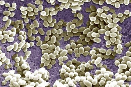 Here's what you need to know about the bacteria, and what happens if you get it. Listeria ivanovii - microbewiki