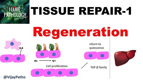 Tissue Repair Part 1 Repair Regeneration Youtube