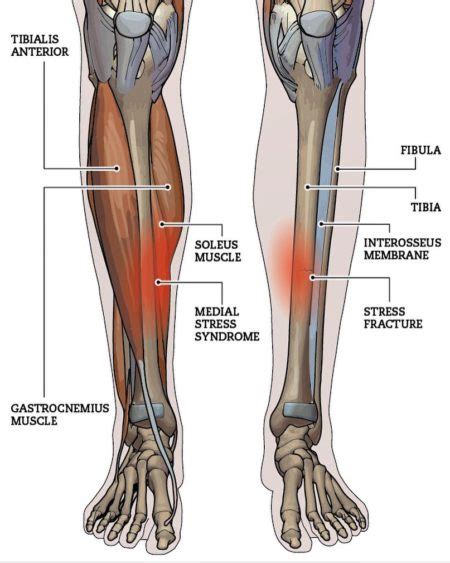 Shin Pain Vasta Performance Training And Physical Therapy