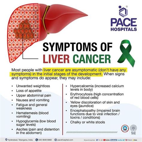 What Is The Final Stage Of Liver Cancer Understanding The Endgame