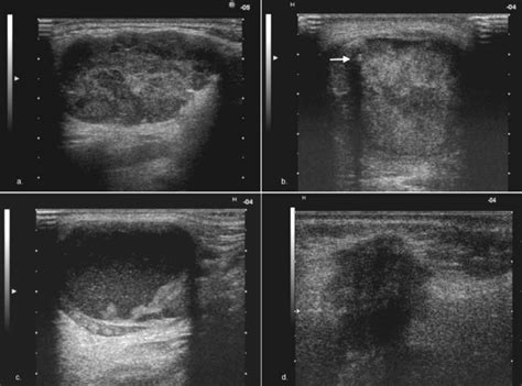 Grayscale Ultrasound Internal Structure Of Different Salivary Gland