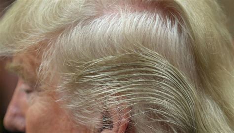 Trumps Doctor Reveals The Secret Behind His Hair Newshub