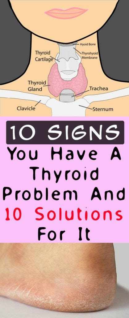 10 Signs You Have A Thyroid Problem And 10 Solutions For It Health