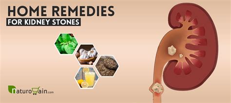 8 Best Home Remedies For Kidney Stones To Improve Kidney Function