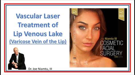 Vascular Laser Treatment Of Venous Lake Varicose Vein On The Lip