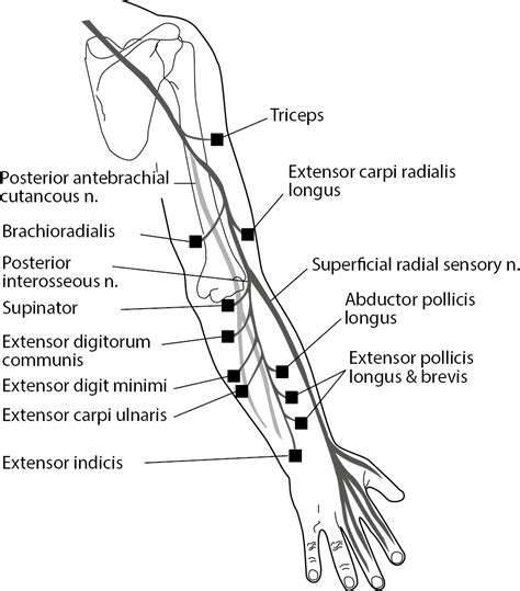 Radial Nerve Anatomy Anatomical Charts And Posters