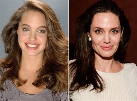 Angelina Jolie Nose Job Plastic Surgery Before And After Photos