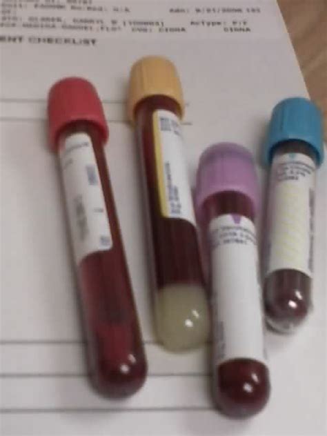 The Order Of Draw For Blood Tubes Mobile Phlebotomy And Paramedical