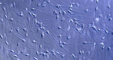 Slow Sperm May Fail At Crashing ‘gates On Their Way To An Egg