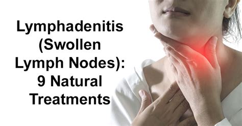 Lymphadenitis Swollen Lymph Nodes 9 Natural Treatments David