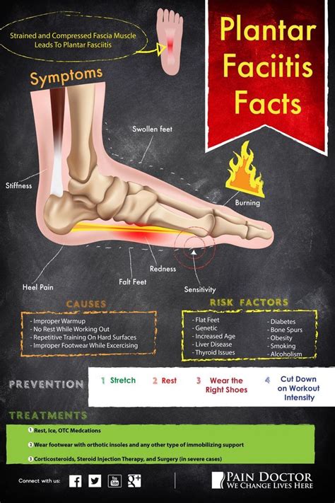 Pin On Plantar Fasciitis Cure