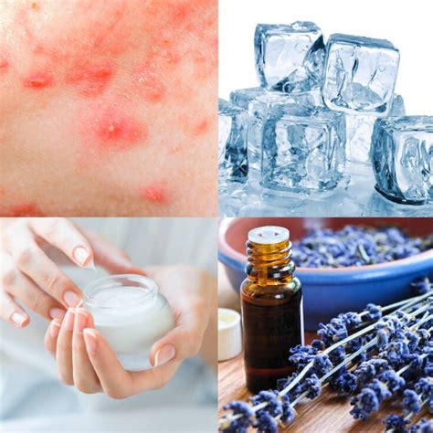 10 Natural Cystic Acne Treatments That Really Work Cystic Acne Back