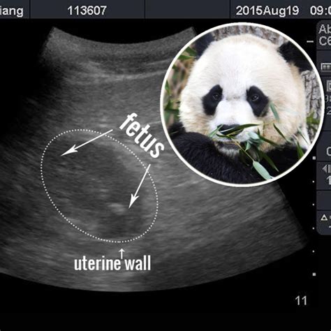 Us Zoo Says Ultrasound Shows Panda Mei Xiang May Be Pregnant And