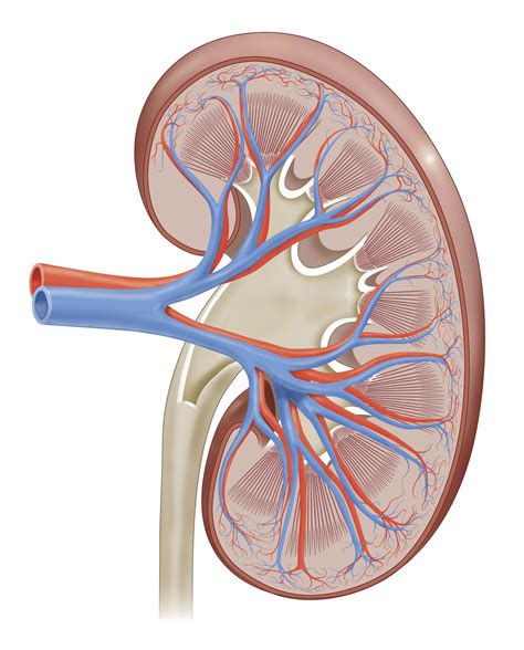 Kidney Stones — Urology Associates