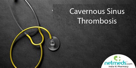 Cavernous Sinus Thrombosis Causes Symptoms And Treatment