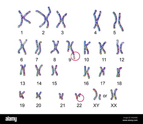 Philadelphia Chromosomecomputer Ilustración Del Cariotipo Masculino O