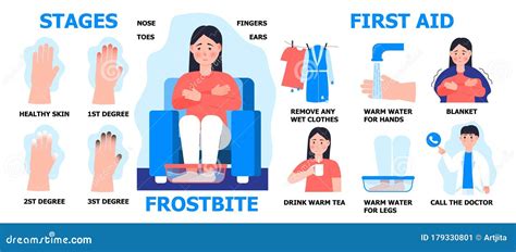 Frostbite Infographics Symptoms Protection And First Aid Medical