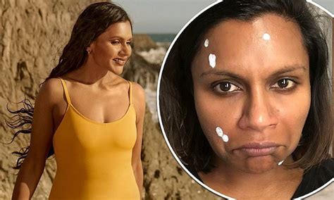 Mindy Kaling Reveals She Struggles With Hyperpigmentation And