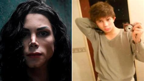 La Transformación Del Joven Argentino Que Se Hizo 13 Cirugías Para Parecerse A Michael Jackson