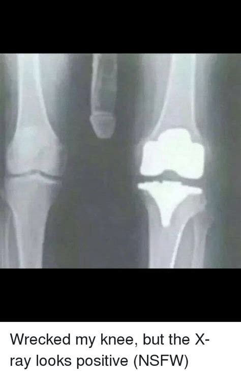 16 Funny X Ray Images Heenahayoung