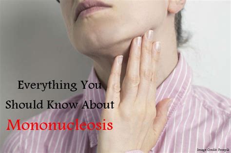 Everything You Should Know About Mononucleosis If You Live Flickr