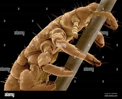 Head Louse Coloured Scanning Electron Micrograph Sem Of A Head Louse