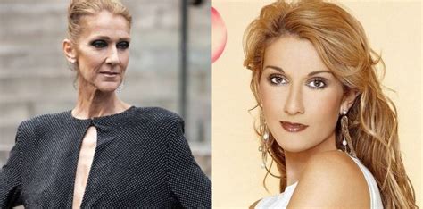 The Truth About Celine Dion Weight Loss And Health