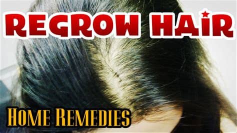 These products are shortlisted based on the overall star rating and the number of customer reviews received by each product in the store, and are. Regrow hair NATURALLY | How to cure BALDNESS for men ...