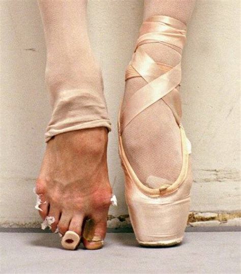 How Do Ballerinas Stand On Their Toes Does That Hurt Quora