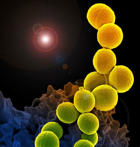 Methicillin Resistant Staphylococcus Aureus Mrsa Flickr Photo