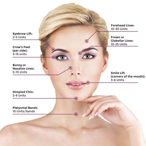 Common Areas For Botox Injection And Appropriate Units Per Injection