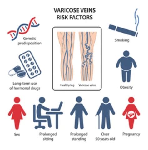 5 Shocking Risk Factors That Trigger Varicose Veins