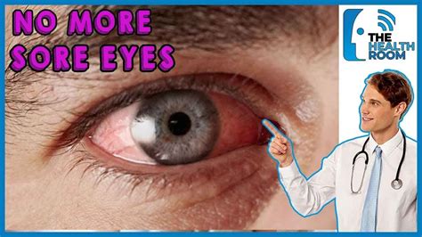 How To Cure Sore Eyes Naturally 10 Effective Ways 2021 Youtube