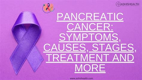 Pancreatic Cancer Symptoms Stages Treatment And More