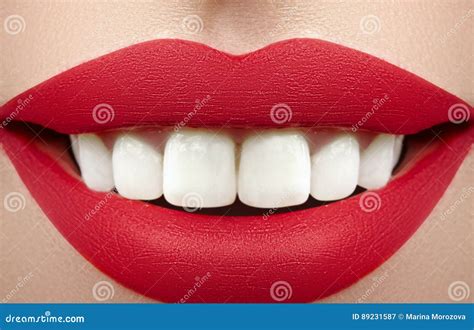 Wide Smile Of Young Beautiful Woman Perfect Healthy White Teeth Dental Whitening Ortodont