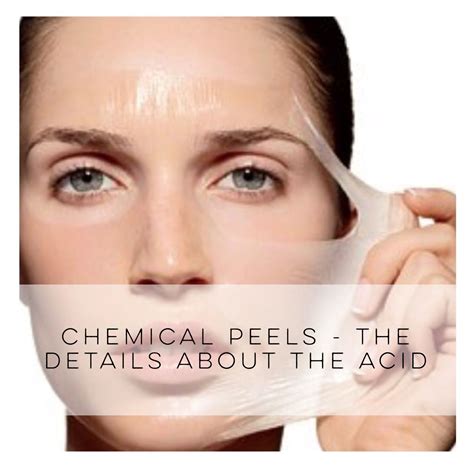 The Truth About Chemical Peels And What You Need To Know Before Going
