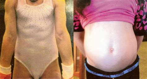 Think Like A Doctor The Gymnasts Big Belly The New York Times