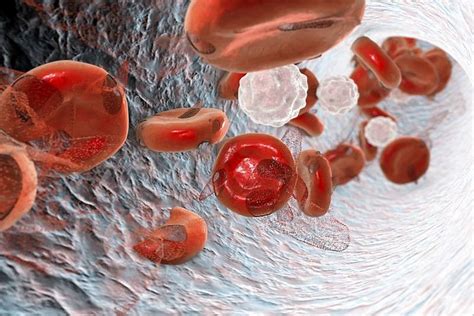 Anemia objawy leczenie przyczyny Czym jest anemia i jak leczyć