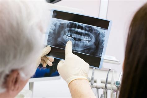 The Importance Of Early X Rays Smiling Kids Pediatric Dentistry