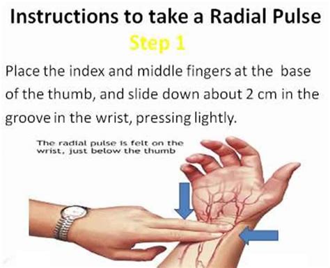 Radial Artery Location In The Arm For Radial Artery Catheterization