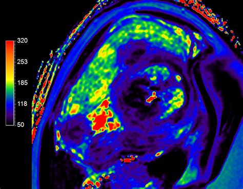 Fetal Cardiac With Smart Sync Philips Mr Body Map